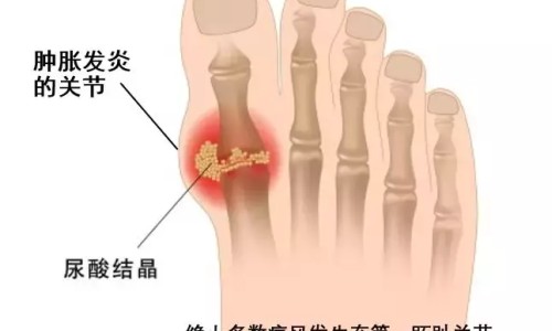【vc泡腾片的正确使用方法】vc泡腾片哪个牌子的效果好 - vc泡腾片的作用与功效网